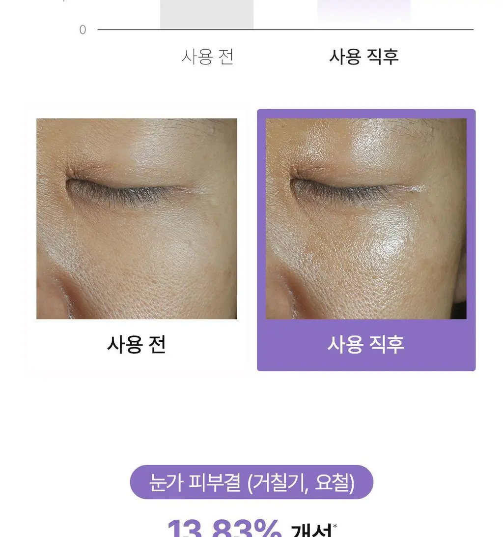 바이오던스 아이패치 60매 2종 택 1 (콜라겐/캐비어 PDRN) 상세페이지 41