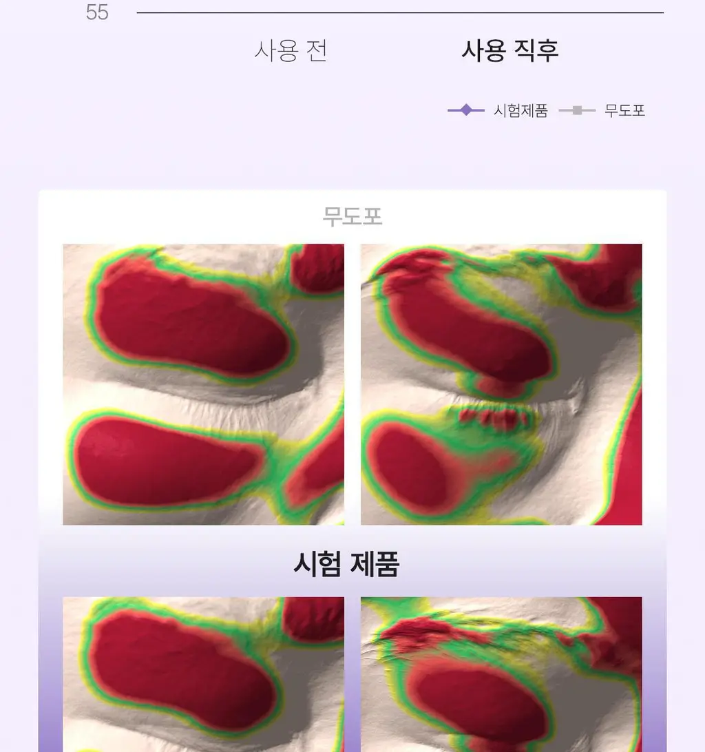 바이오던스 아이패치 60매 2종 택 1 (콜라겐/캐비어 PDRN) 상세페이지 44