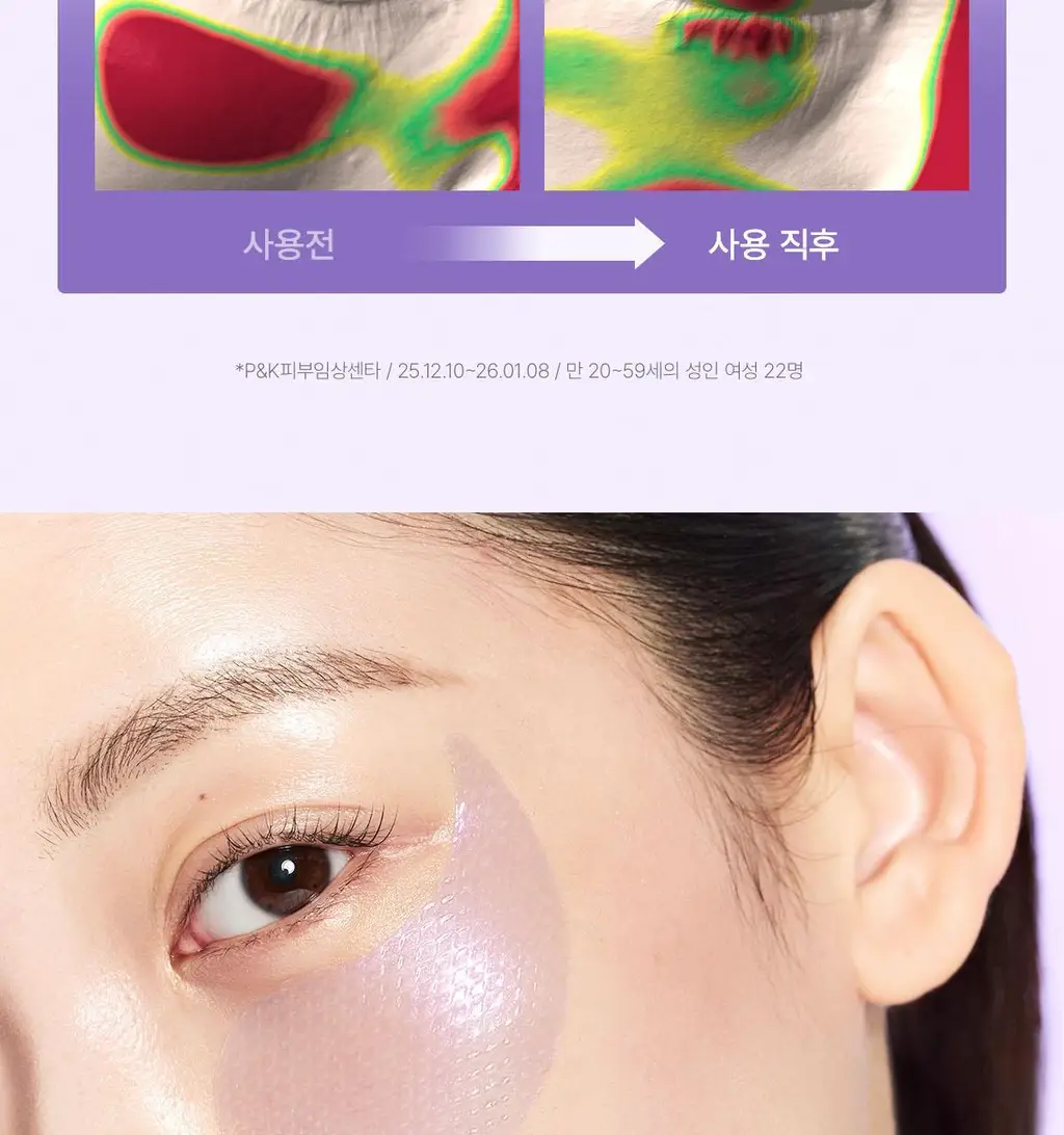 바이오던스 아이패치 60매 2종 택 1 (콜라겐/캐비어 PDRN) 상세페이지 45