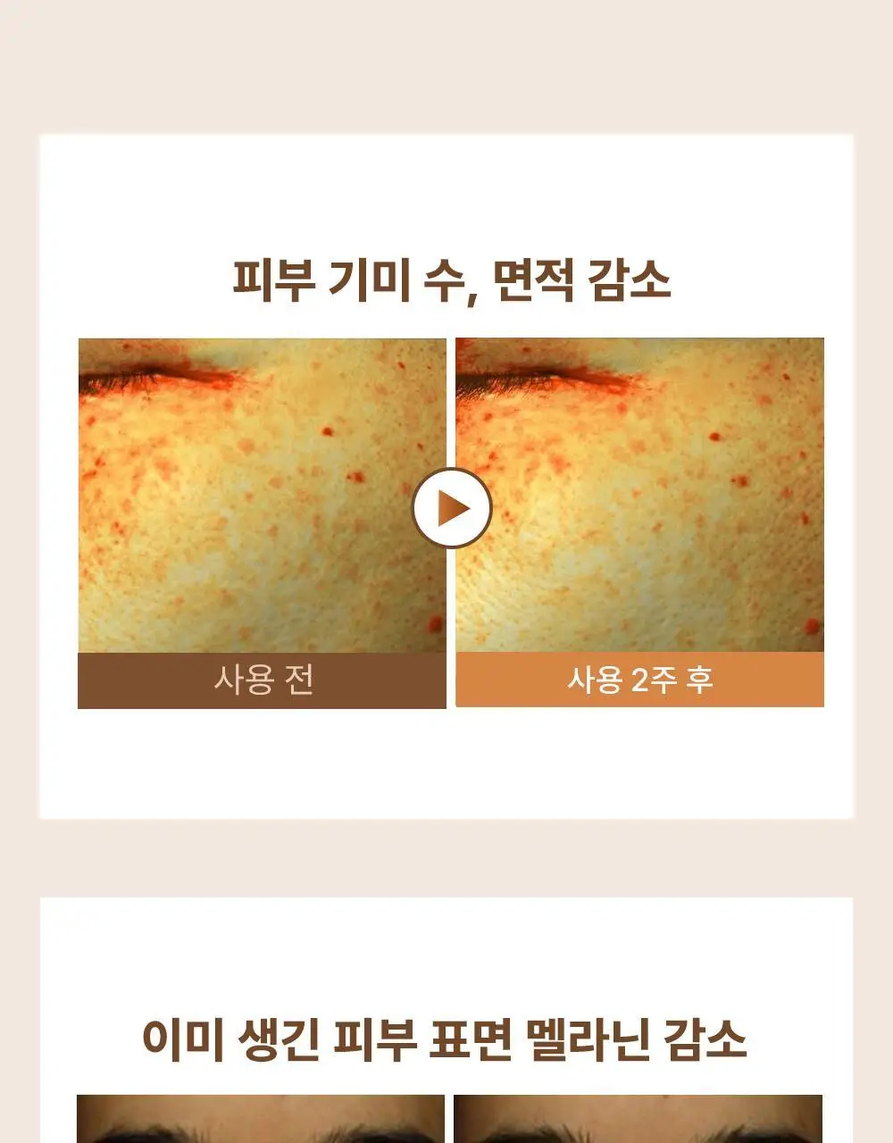 에이바자르 멜라컨트롤 화이트닝 아이패치 1매 상세페이지 7