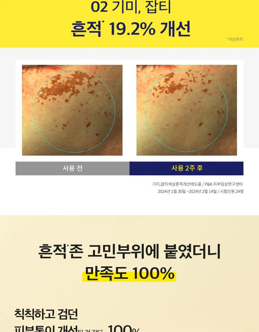 CKD 비타씨테카 트리플 흔적패치 60매 상세페이지 6