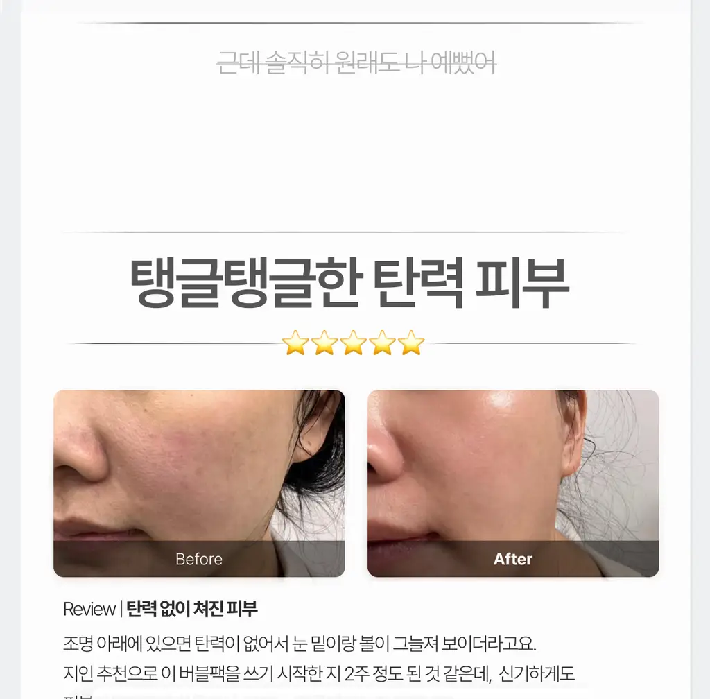 가쉬 모공탄력/수분/진정/미백 10초 마이크로 버블팩 4종 골라담기 150회분 상세페이지 43