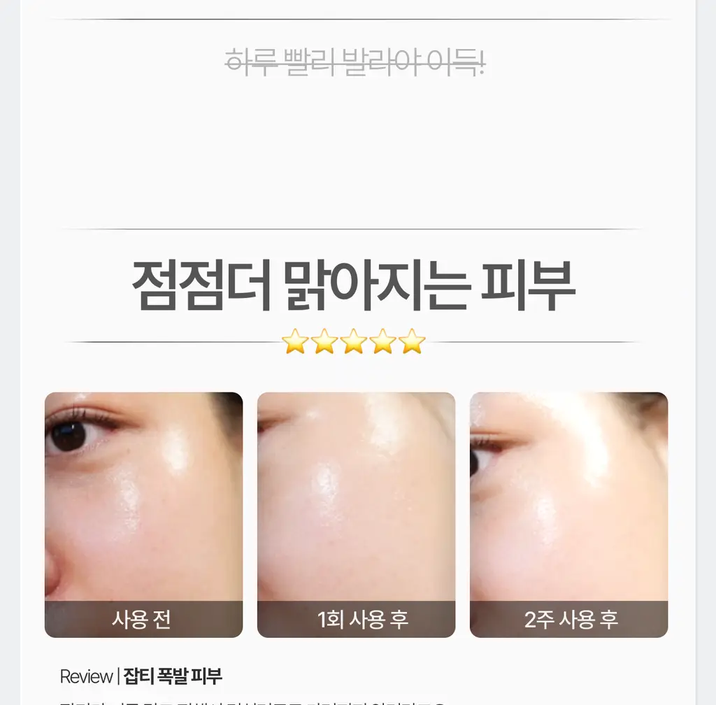 가쉬 모공탄력/수분/진정/미백 10초 마이크로 버블팩 4종 골라담기 150회분 상세페이지 54