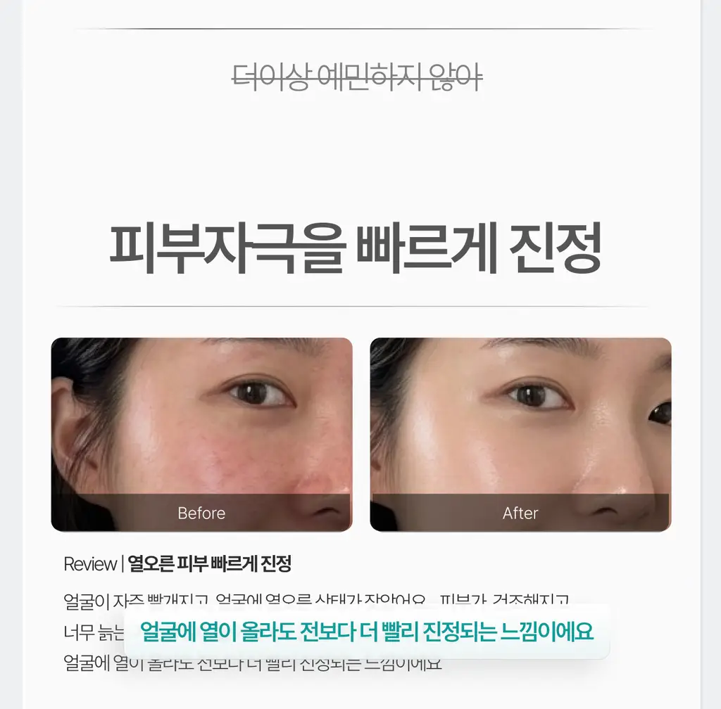가쉬 모공탄력/수분/진정/미백 10초 마이크로 버블팩 4종 골라담기 150회분 상세페이지 65