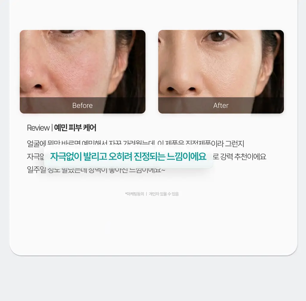 가쉬 모공탄력/수분/진정/미백 10초 마이크로 버블팩 4종 골라담기 150회분 상세페이지 66