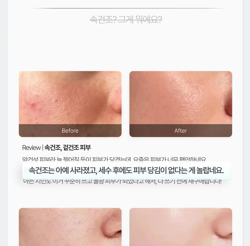 가쉬 모공탄력/수분/진정/미백 10초 마이크로 버블팩 4종 골라담기 150회분 상세페이지 76