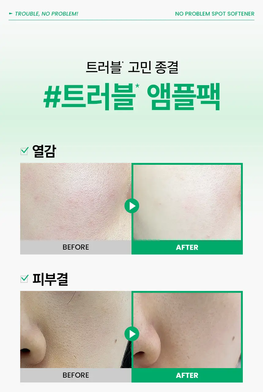 일소 노 트러블럼 스팟 소프트너 앰플팩 150g+솜 40매 증정 기획 상세페이지 5