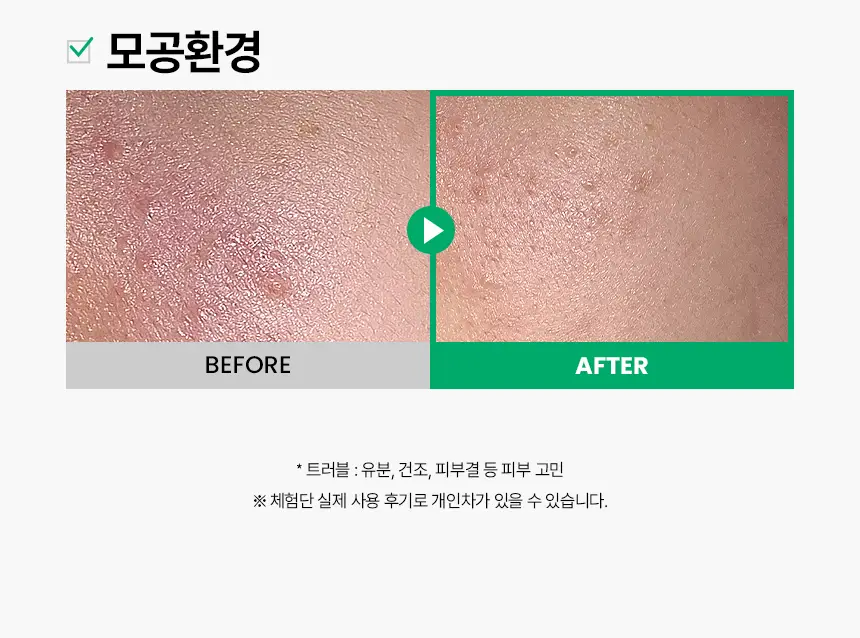 일소 노 트러블럼 스팟 소프트너 앰플팩 150g+솜 40매 증정 기획 상세페이지 6