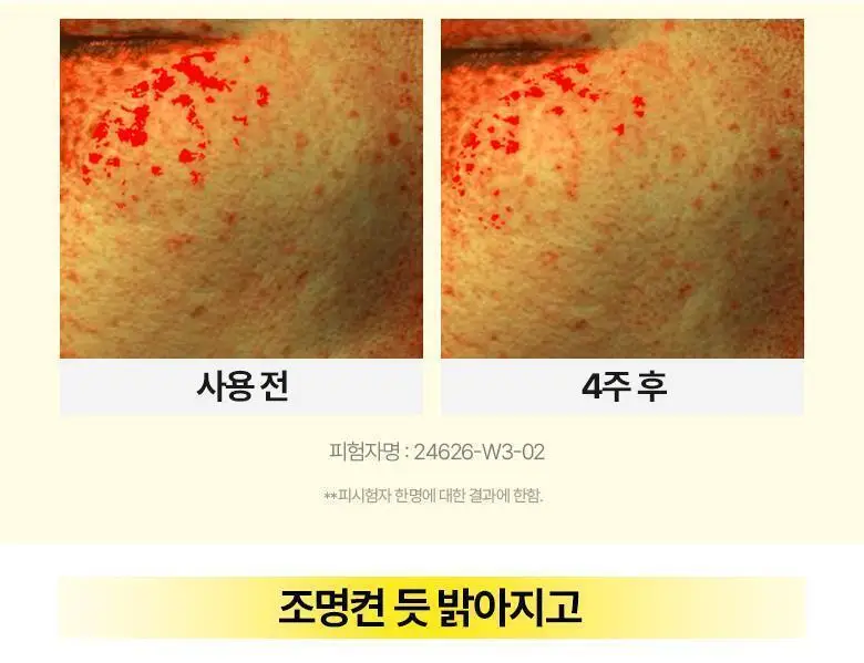브링그린 슈퍼레몬 글루타치온 슬리핑팩 100mL 기획 (+실리콘 브러쉬) 상세페이지 20