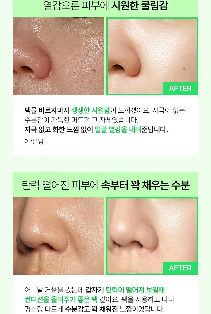 샤이샤이샤이 알로에 PDRN 쿨링 머드 마스크 100ml (온) 상세페이지 9