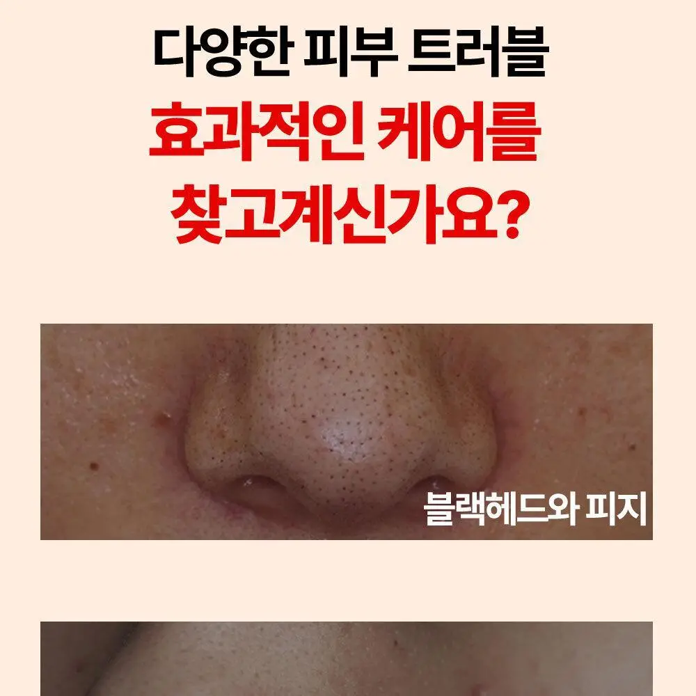 선덕제주 케라바이옴엑스 리벨런스 프레쉬 버블팩 상세페이지 3