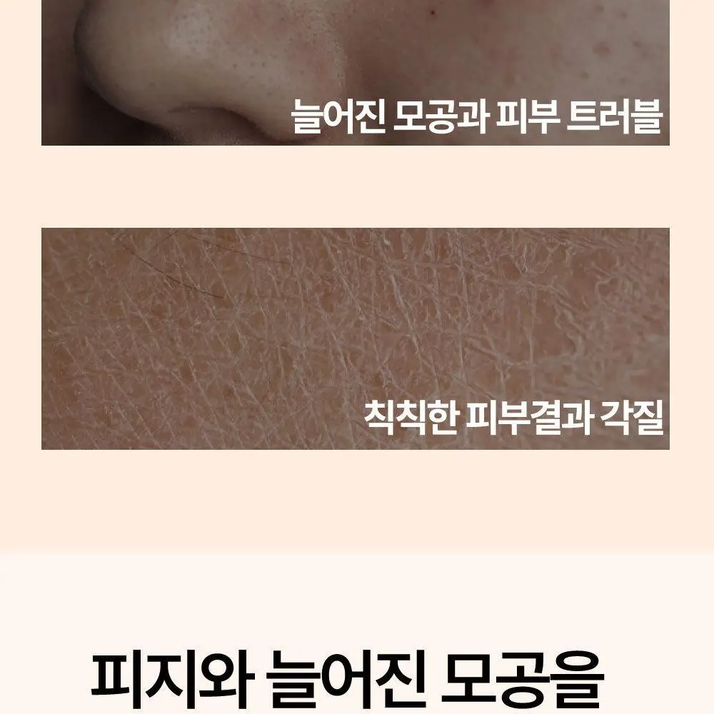 선덕제주 케라바이옴엑스 리벨런스 프레쉬 버블팩 상세페이지 4