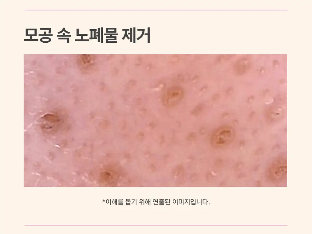 아임프롬 비트 퓨리파잉 마스크 70g 상세페이지 20