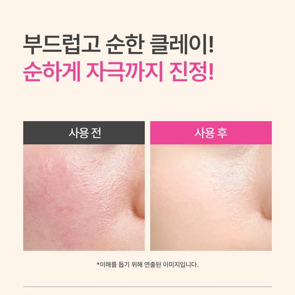 아임프롬 비트 퓨리파잉 마스크 70g 상세페이지 27