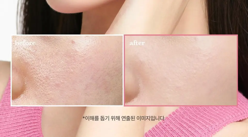 아임프롬 피그 스크럽 마스크 70g 상세페이지 9