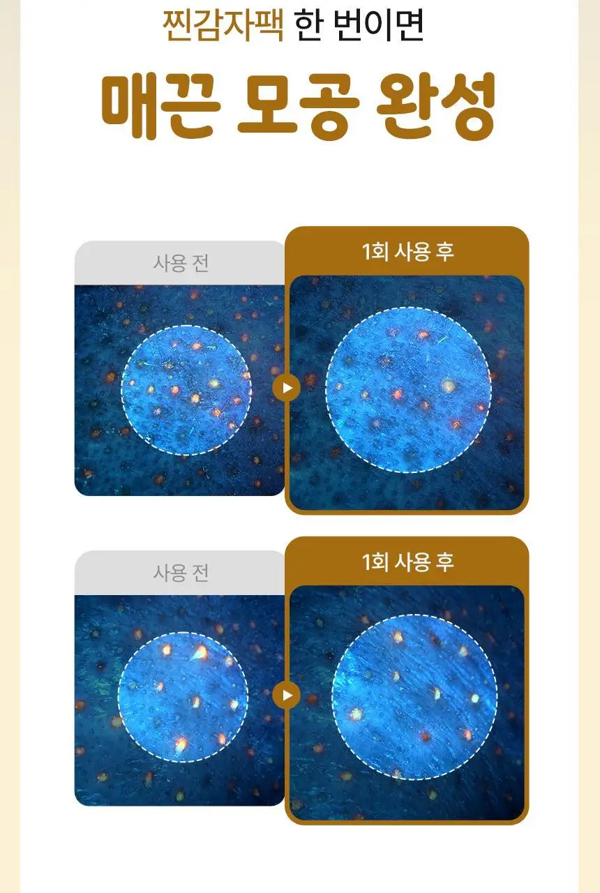 일소 라이스 포테이토 포어 프레쉬 워시오프 150g 기획 (+감자세안밴드) (부실감자 콜라보) 상세페이지 18