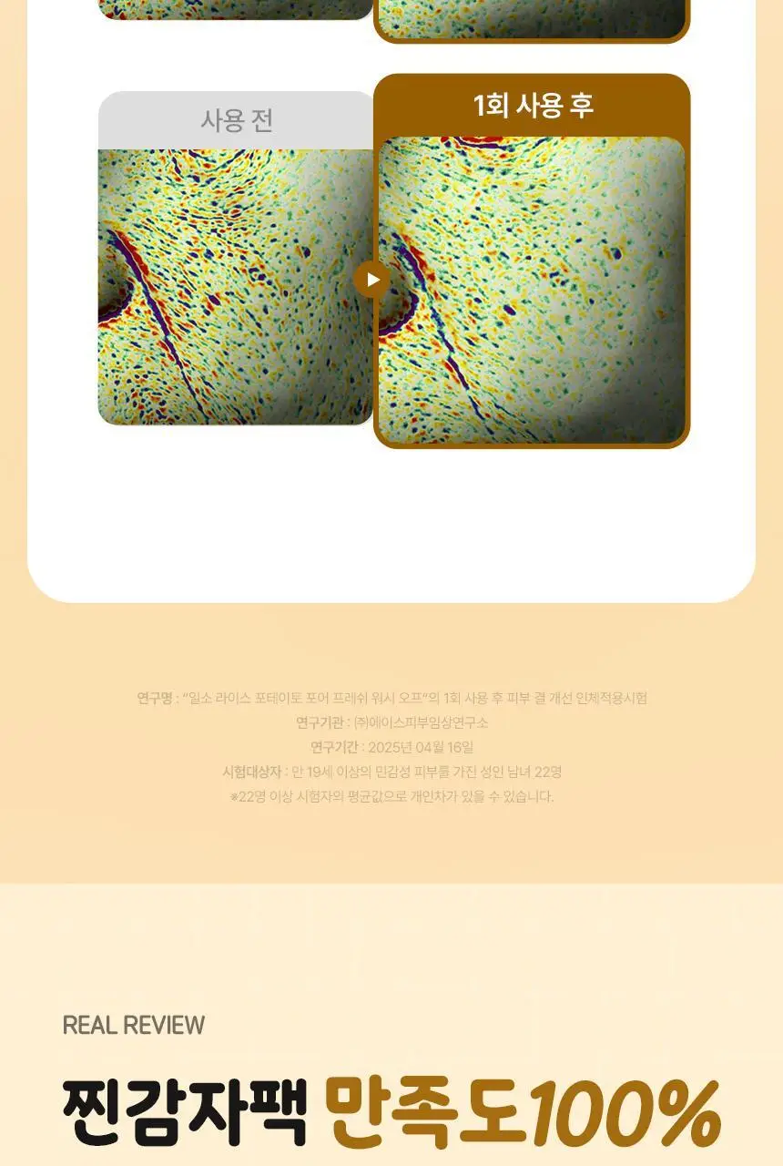 일소 라이스 포테이토 포어 프레쉬 워시오프 150g 기획 (+감자세안밴드) (부실감자 콜라보) 상세페이지 23