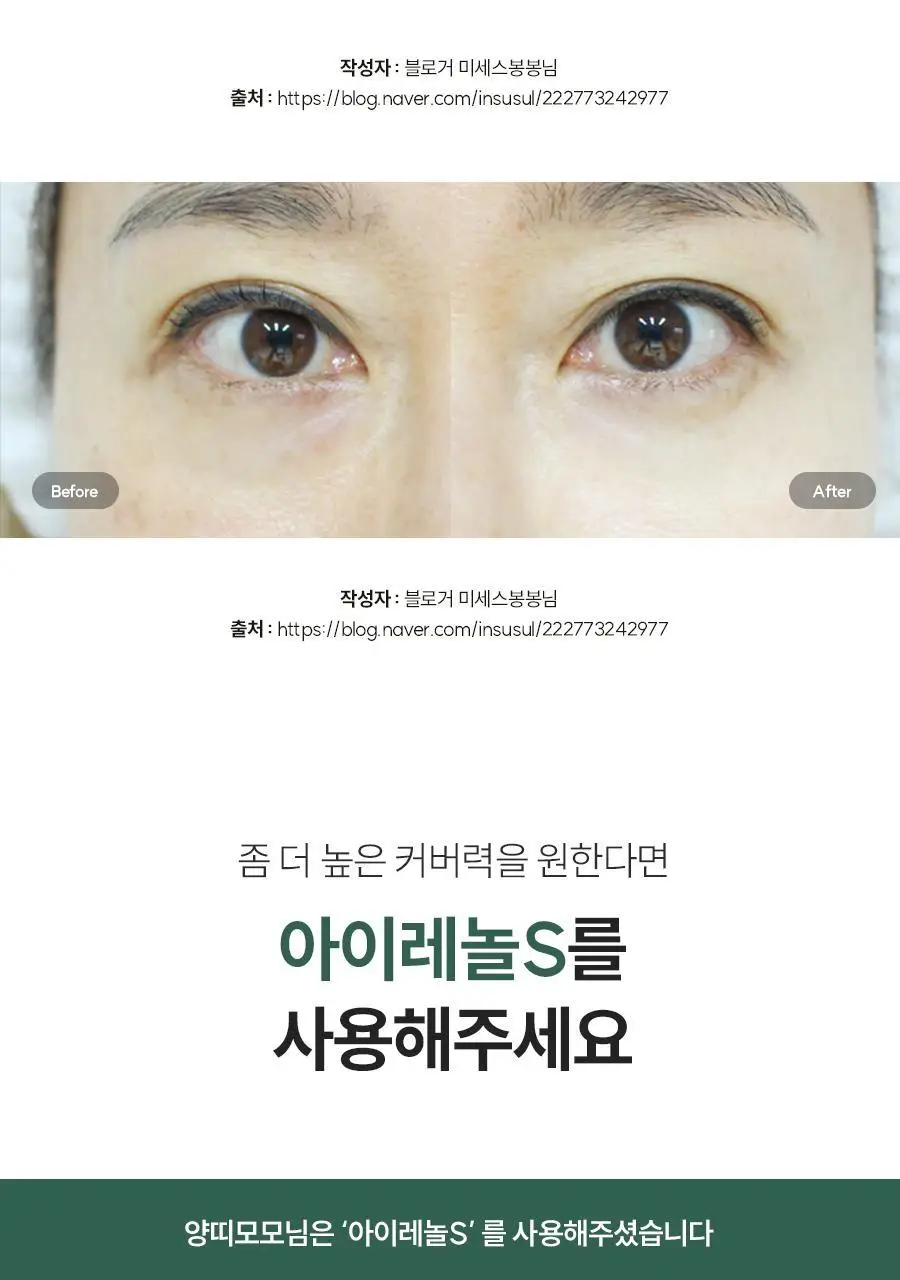 아이레놀 다크서클 크림 3종 (촉촉하고 자연스러운 커버) 상세페이지 31