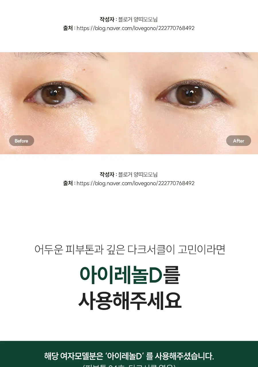 아이레놀 다크서클 크림 3종 (촉촉하고 자연스러운 커버) 상세페이지 35