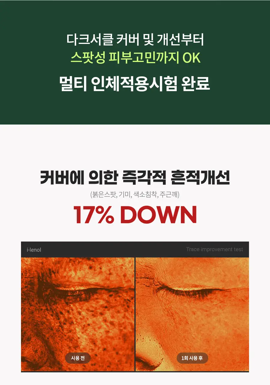 아이레놀 다크서클 크림 3종 (촉촉하고 자연스러운 커버) 상세페이지 53