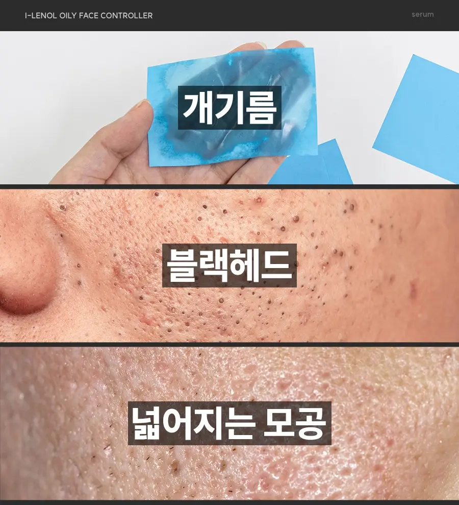 아이레놀 개기름 컨트롤러 30g (실리콘 Free/피지조절/모공수축) 상세페이지 12