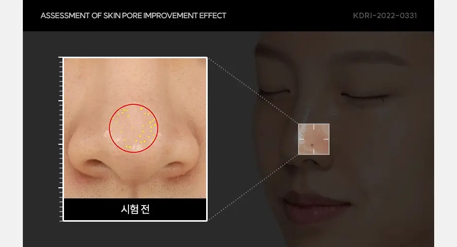 아이레놀 개기름 컨트롤러 30g (실리콘 Free/피지조절/모공수축) 상세페이지 37
