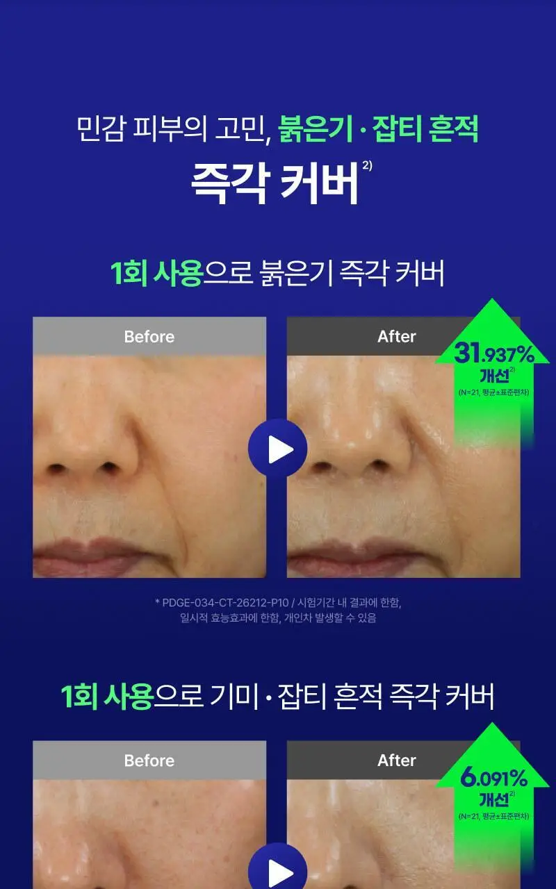 이지듀 EGFx 다운타임 BB 35ml 상세페이지 29