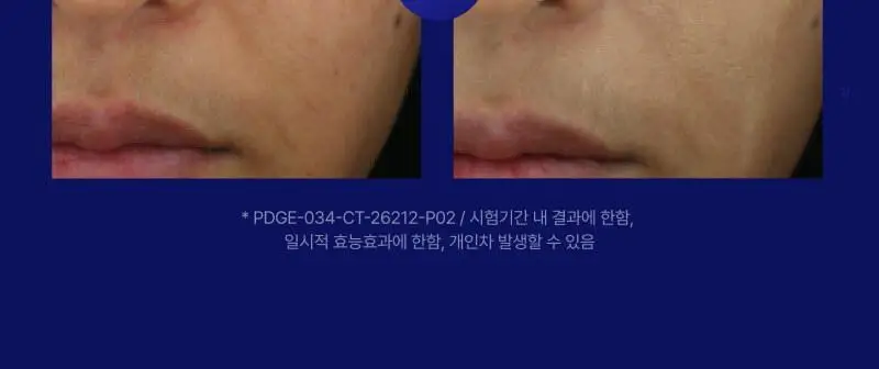 이지듀 EGFx 다운타임 BB 35ml 상세페이지 30