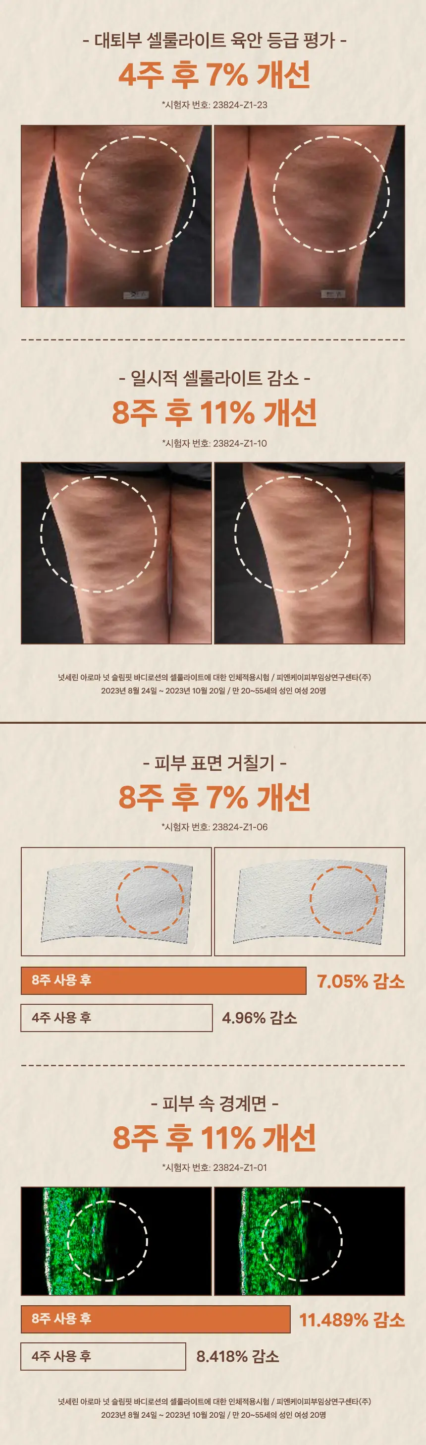 넛세린 아로마 넛 슬림핏 바디로션 200ml 기획 (+바디로션 30ml 증정) 상세페이지 6