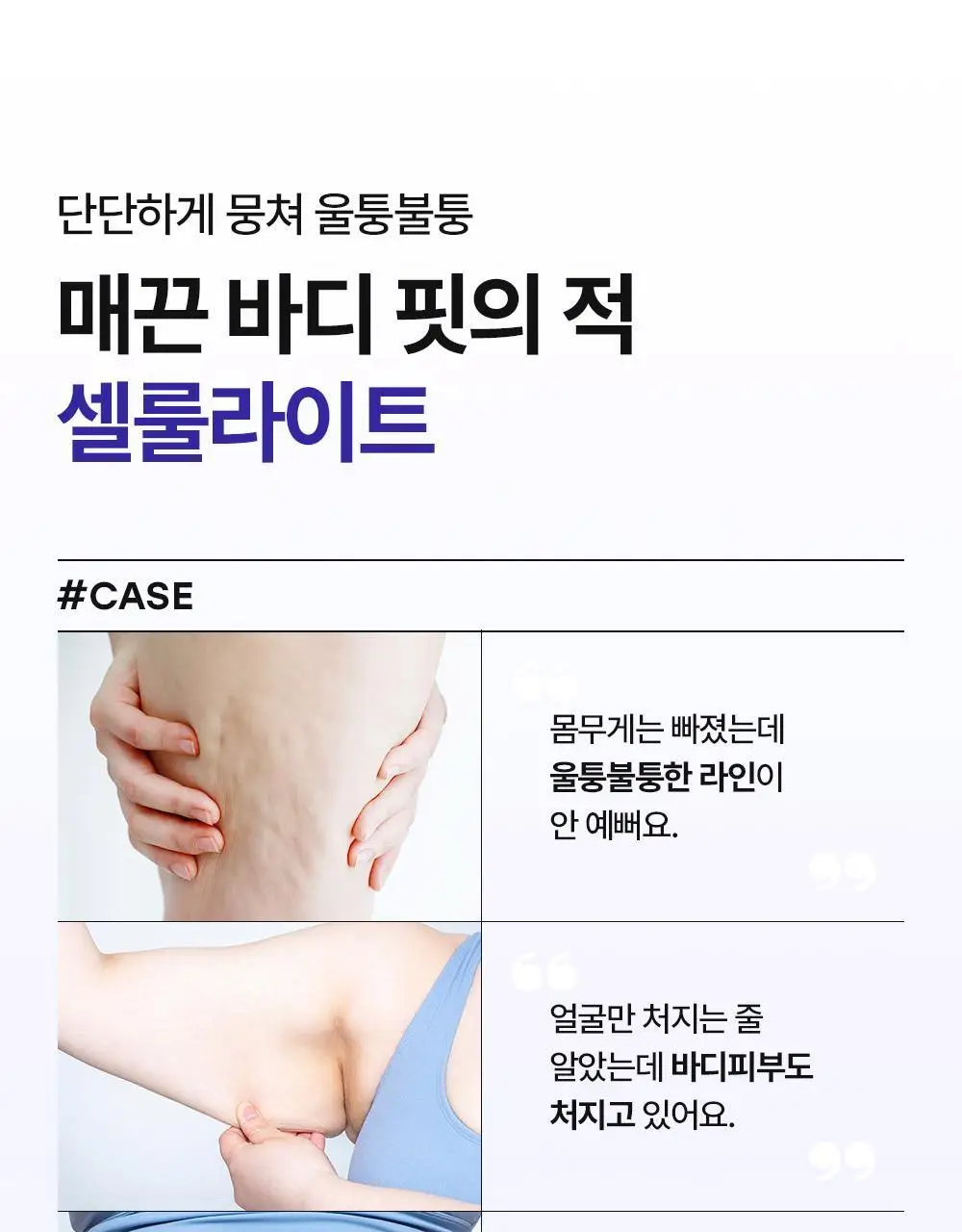 더마비 밸런스핏 바디세럼 380ml 상세페이지 4