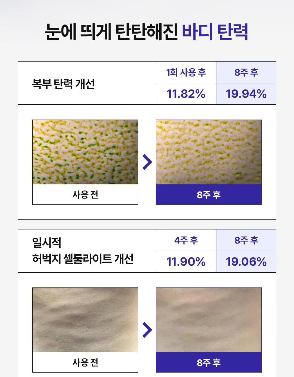 더마비 밸런스핏 바디세럼 380ml 상세페이지 15