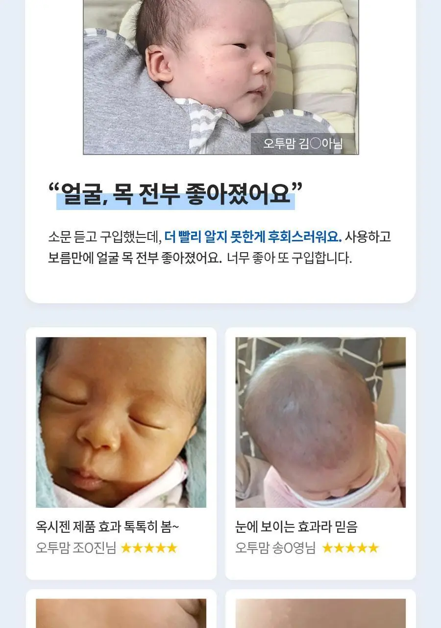 아토앤오투 옥시젠 수딩젤 160g 상세페이지 4