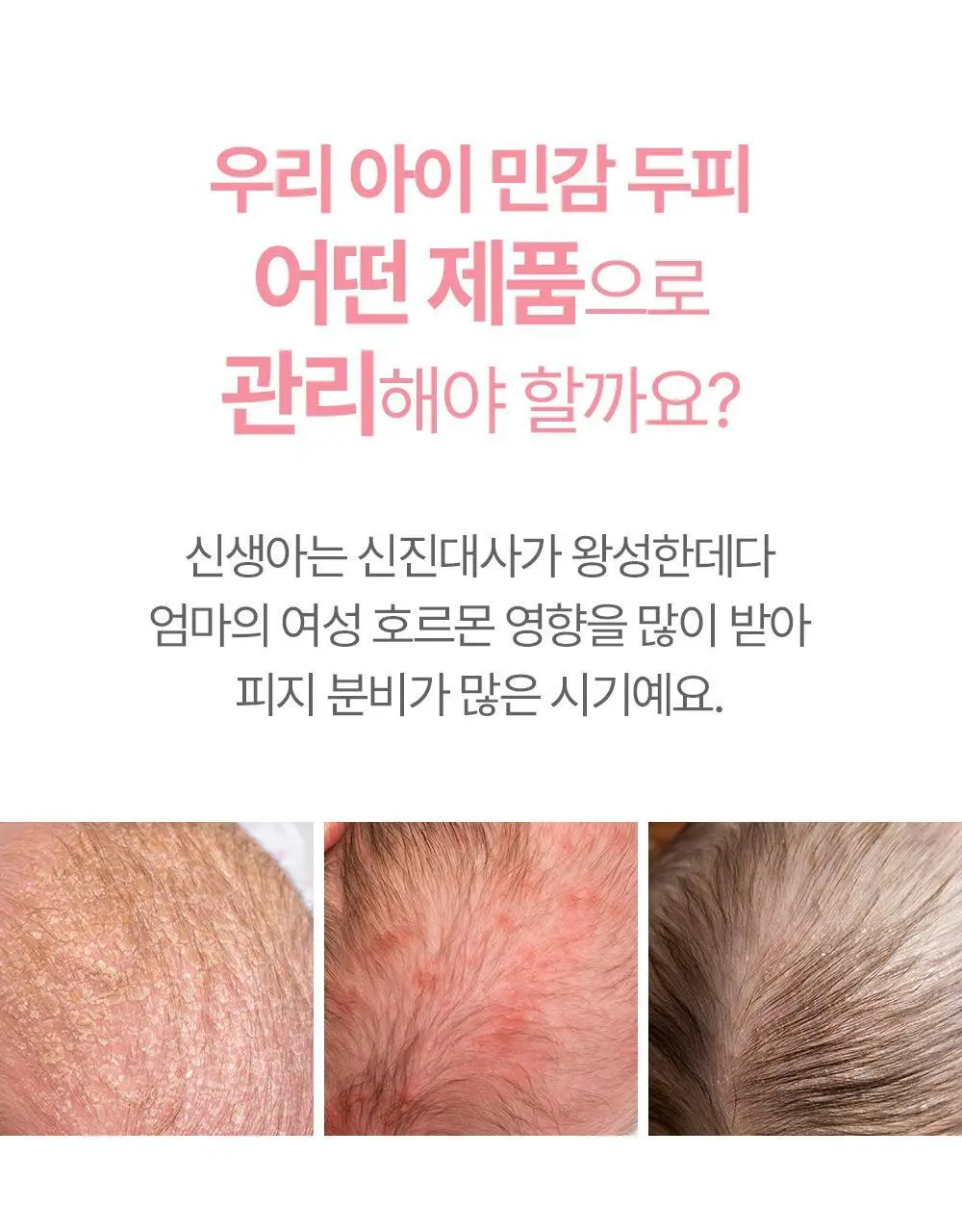 아토팜 뉴본 스칼프 로션 100g 상세페이지 5