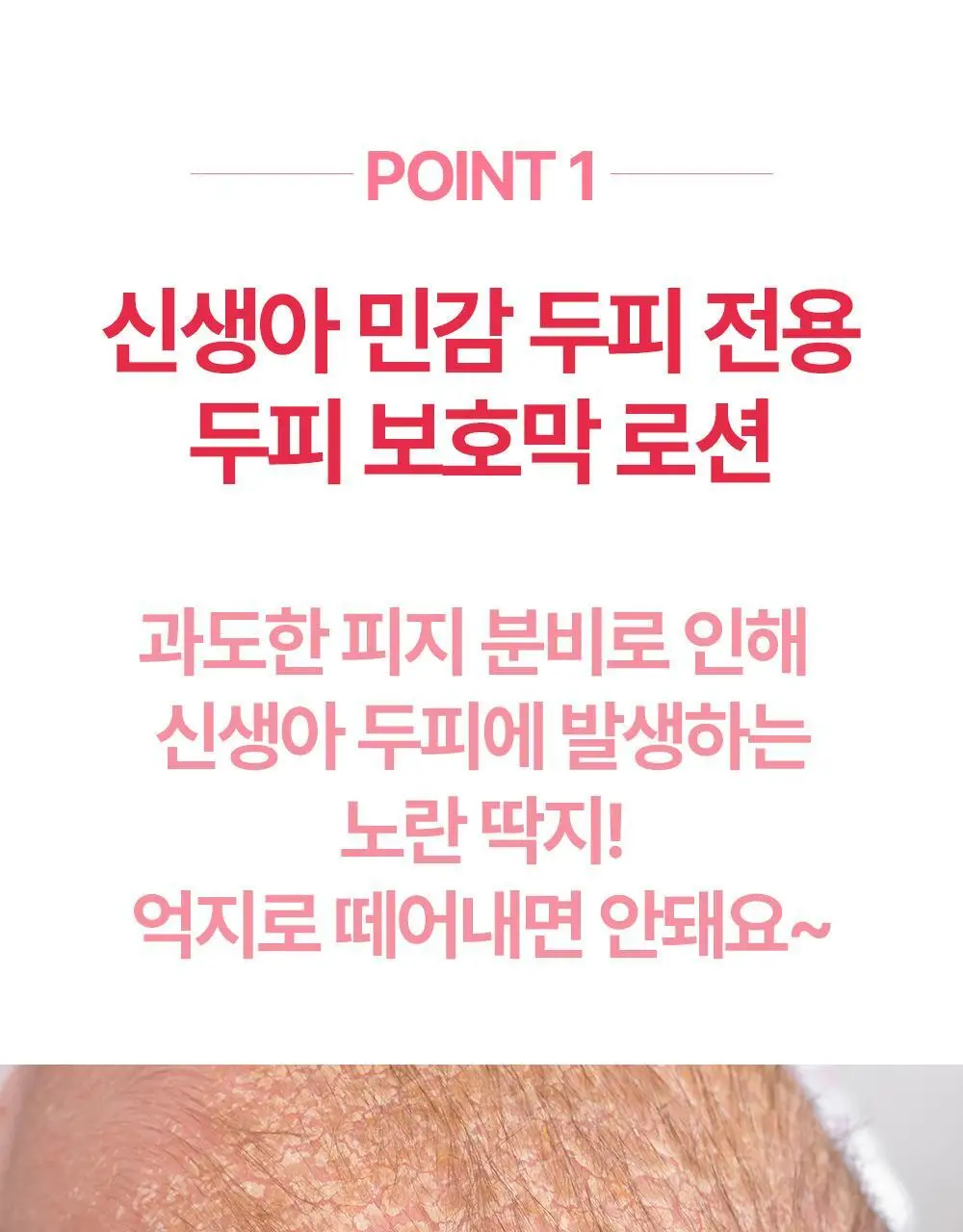 아토팜 뉴본 스칼프 로션 100g 상세페이지 10