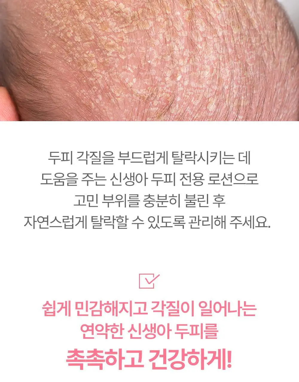 아토팜 뉴본 스칼프 로션 100g 상세페이지 11