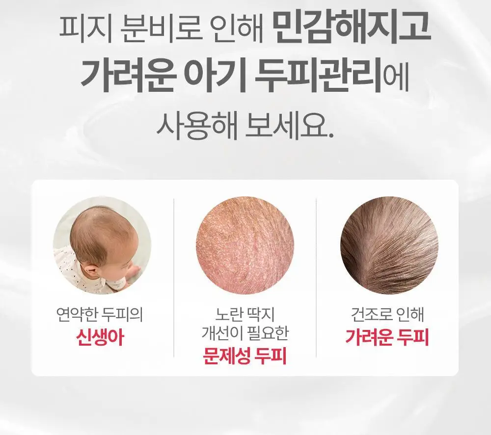 아토팜 뉴본 스칼프 로션 100g 상세페이지 37
