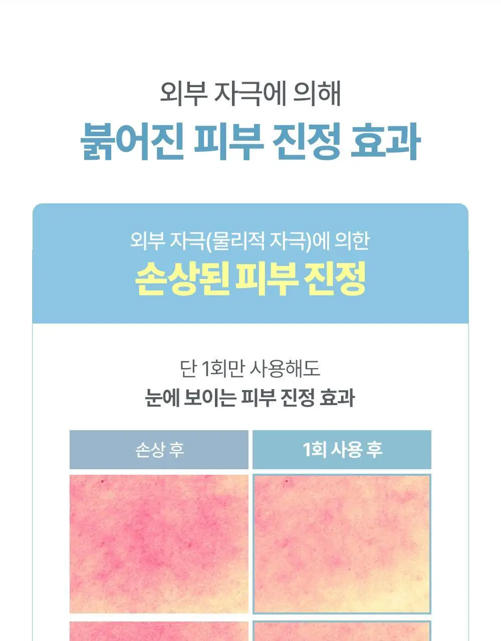 아토팜 판테놀 로션 180ml 상세페이지 41