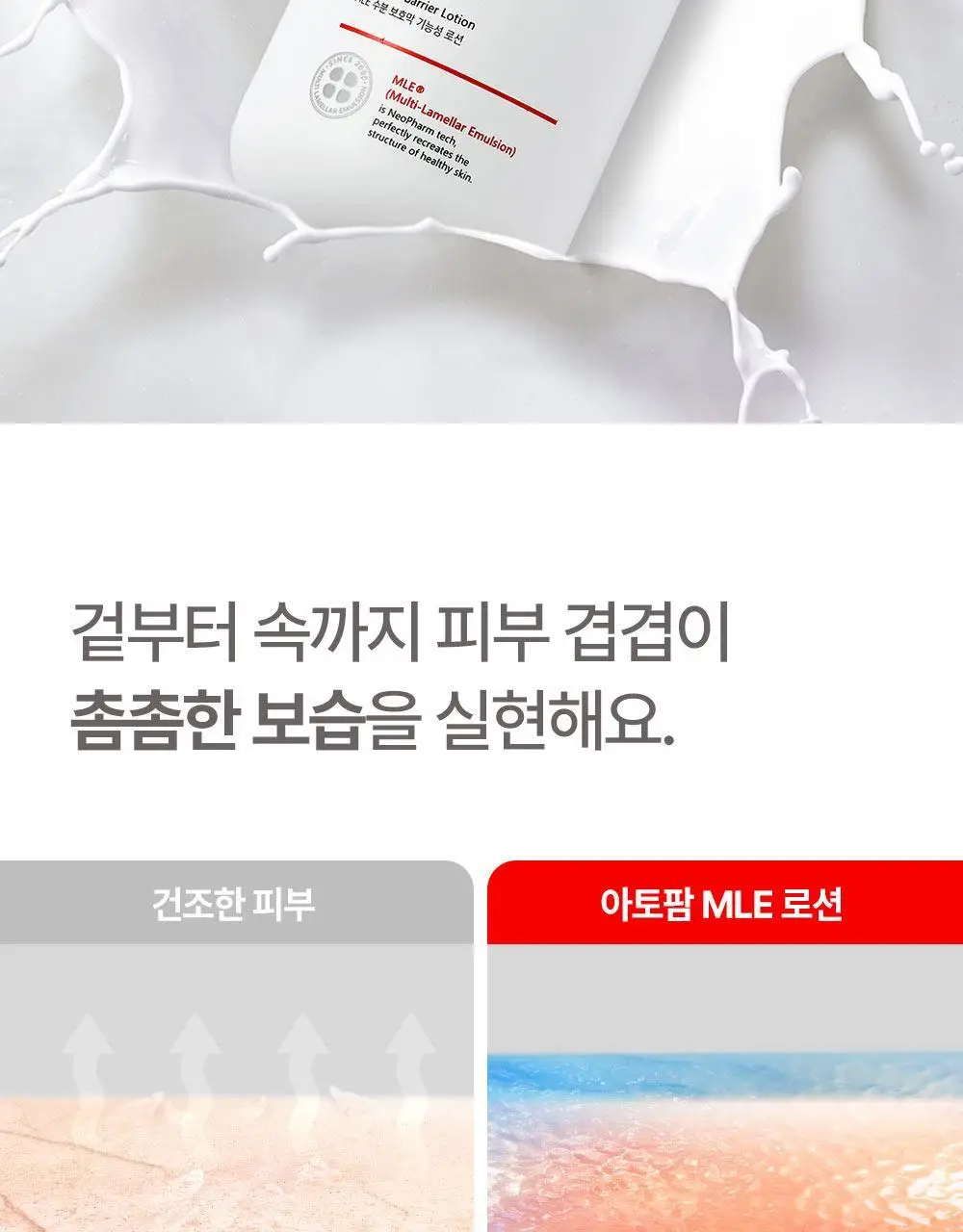 아토팜 MLE 로션 200ml 상세페이지 33
