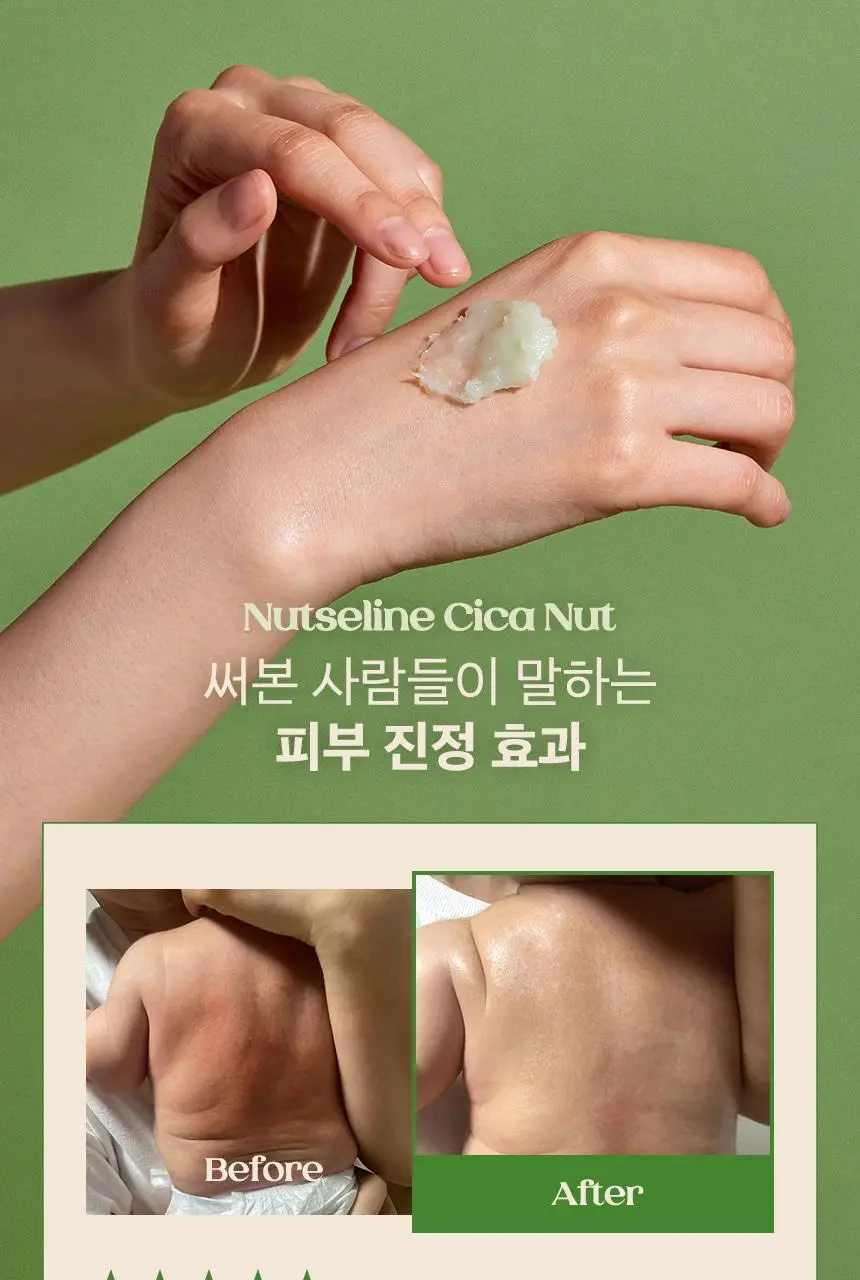 넛세린 시카 넛 카밍 밤 50ml 상세페이지 22
