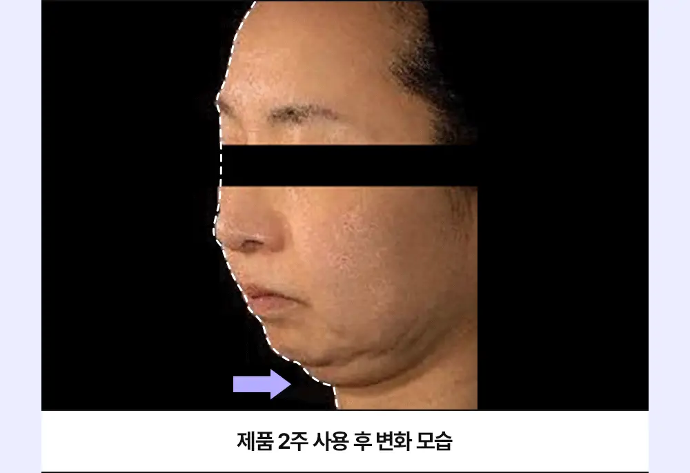 더마비 밸런스핏 넥크림 60ml 상세페이지 11