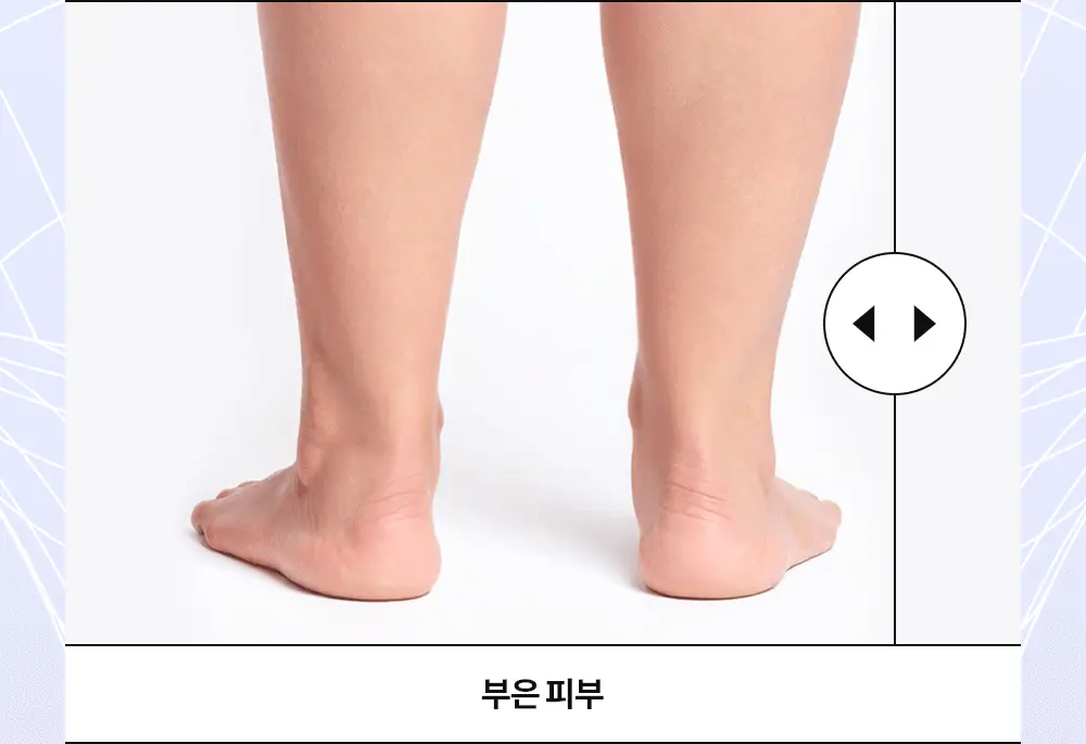 더마비 밸런스핏 바디크림 380ml 상세페이지 7