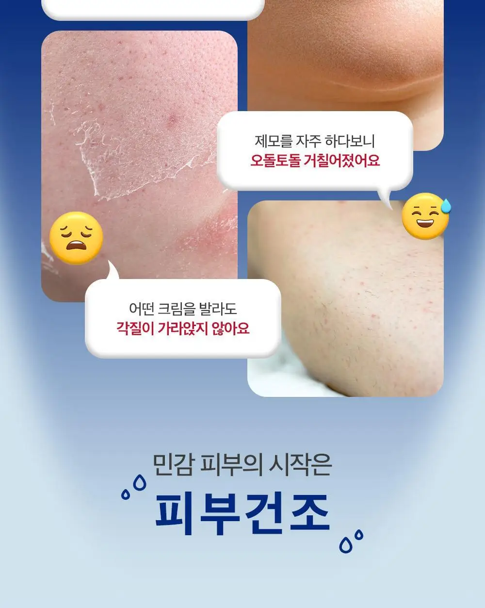 더마비 세라엠디 리페어 D-판테밤 50ml 상세페이지 4