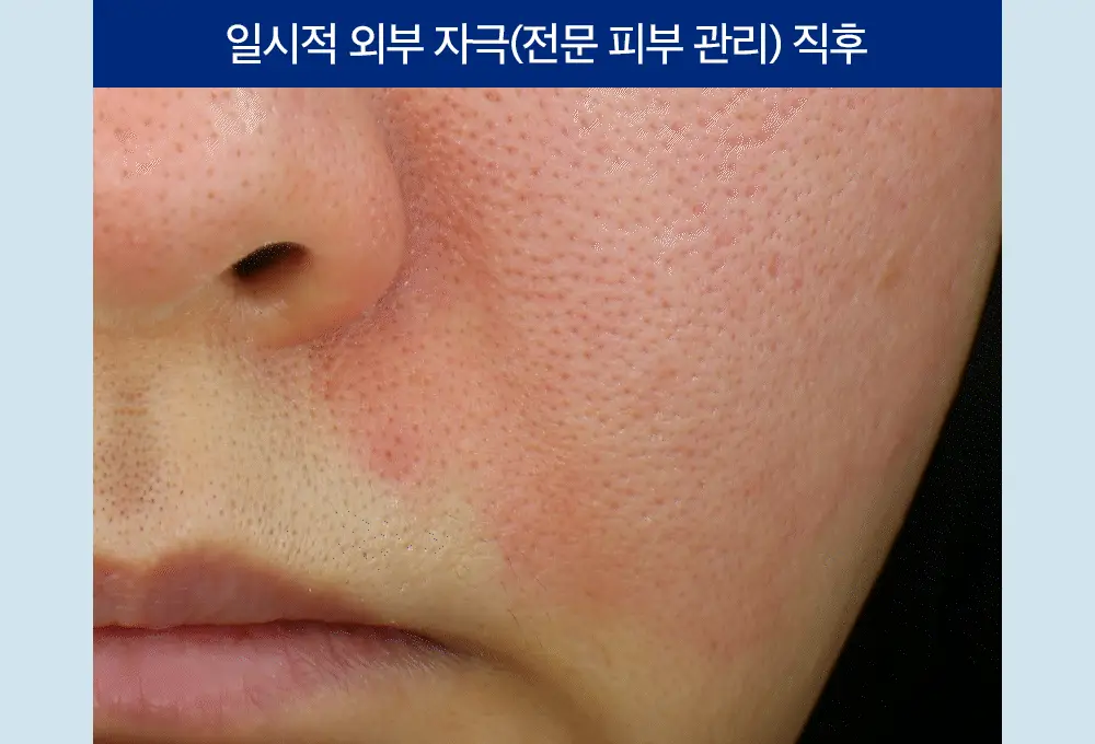더마비 세라엠디 리페어 D-판테밤 50ml 상세페이지 26