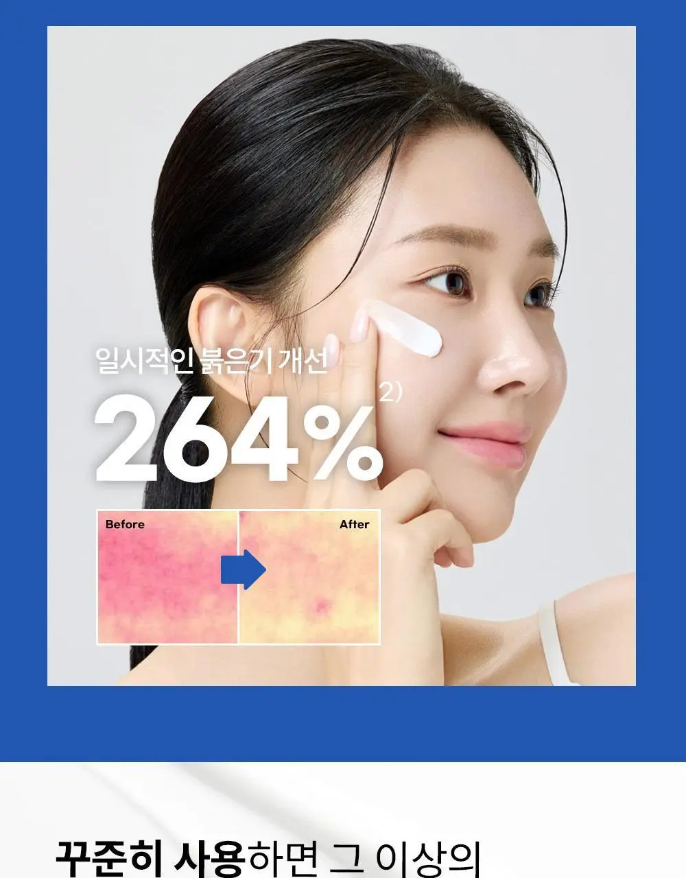 아이보들 CCP 크림 50ml 기획 (+30ml 추가 증정) 상세페이지 14
