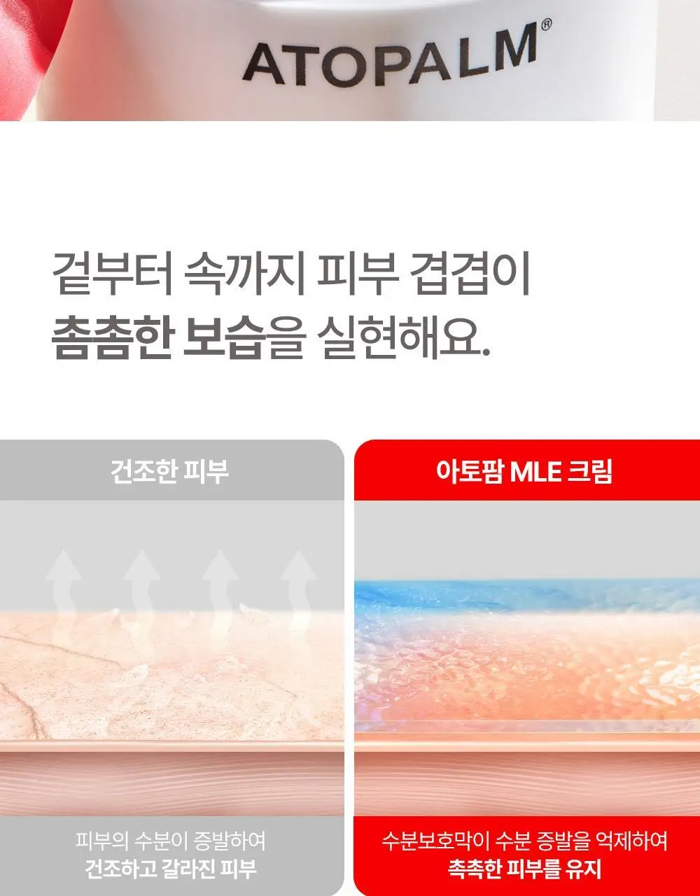 아토팜 MLE 크림 100ml 단품/기획 택1 상세페이지 31