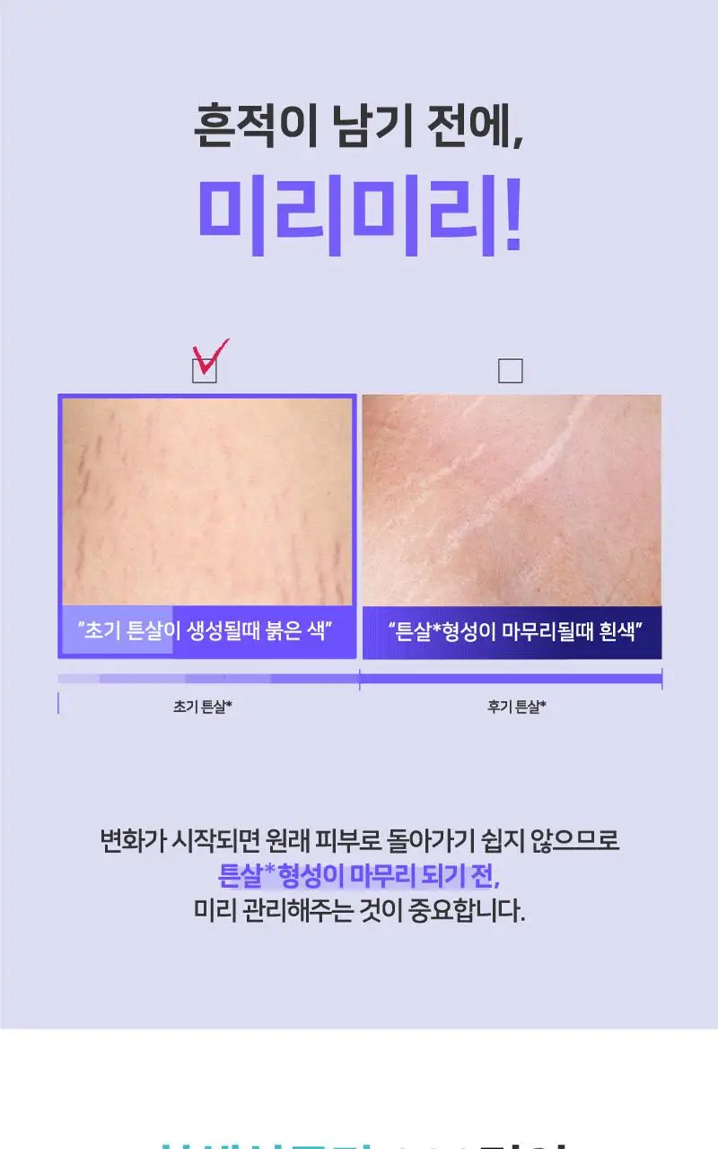 일리윤 튼살 크림(200ML/330ML) 상세페이지 5