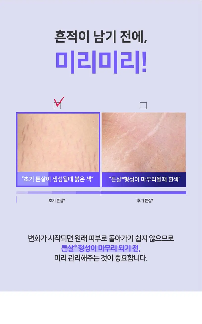 일리윤 튼살 크림(200ML/330ML) 상세페이지 22