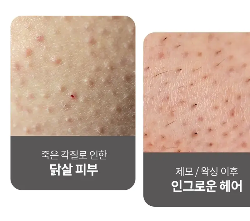 고릴라왁싱 젤리슈가 왁싱 스크럽 200g 상세페이지 27