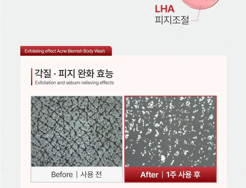 노도르 아크네 블레미쉬 바디워시 460ml 상세페이지 20