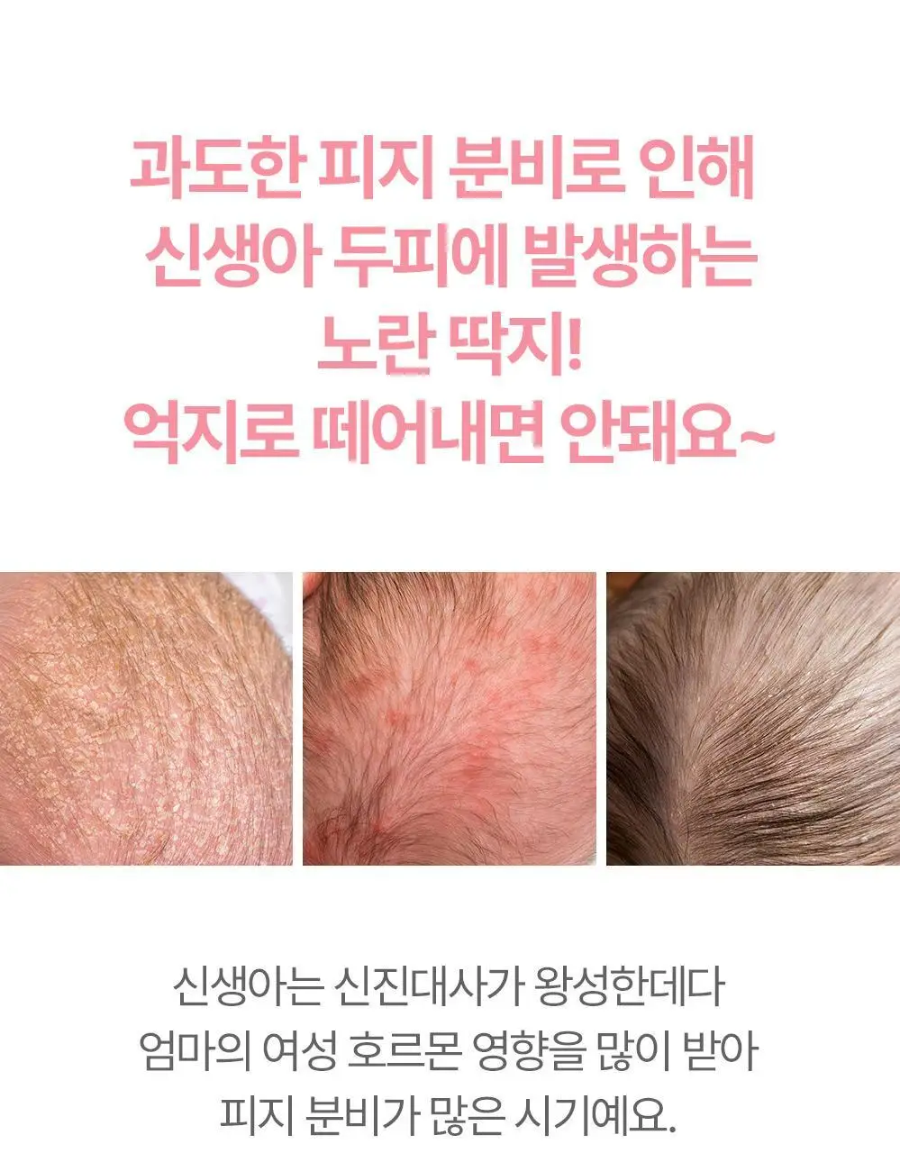 아토팜 뉴본 스칼프 샴푸 300ml 상세페이지 7